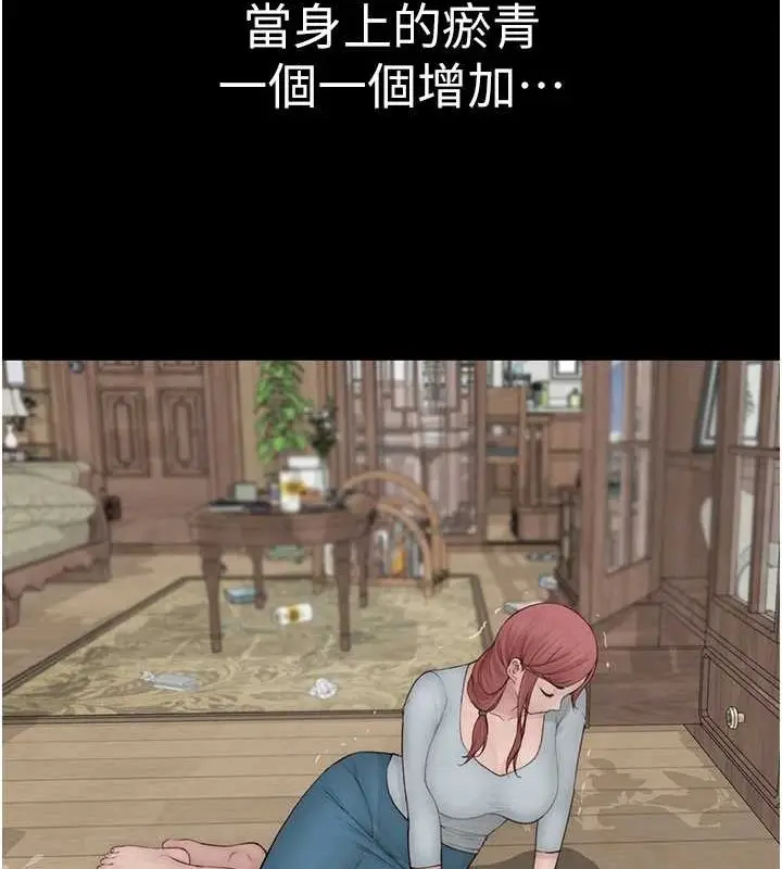 132
